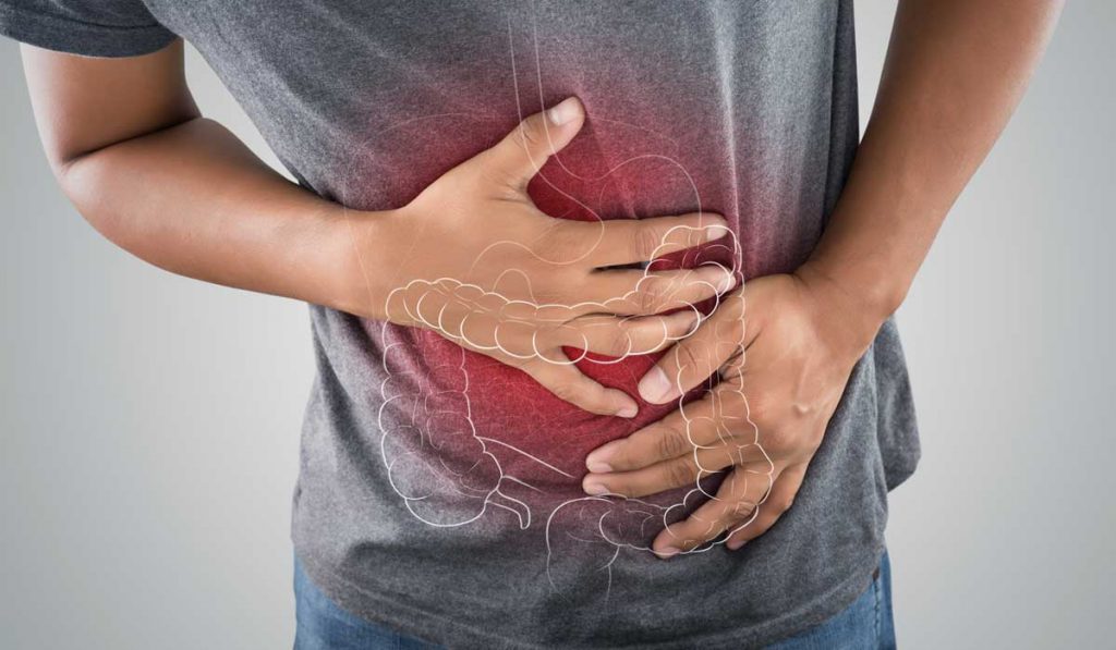 Especialista en colitis en San Luis Potosí
