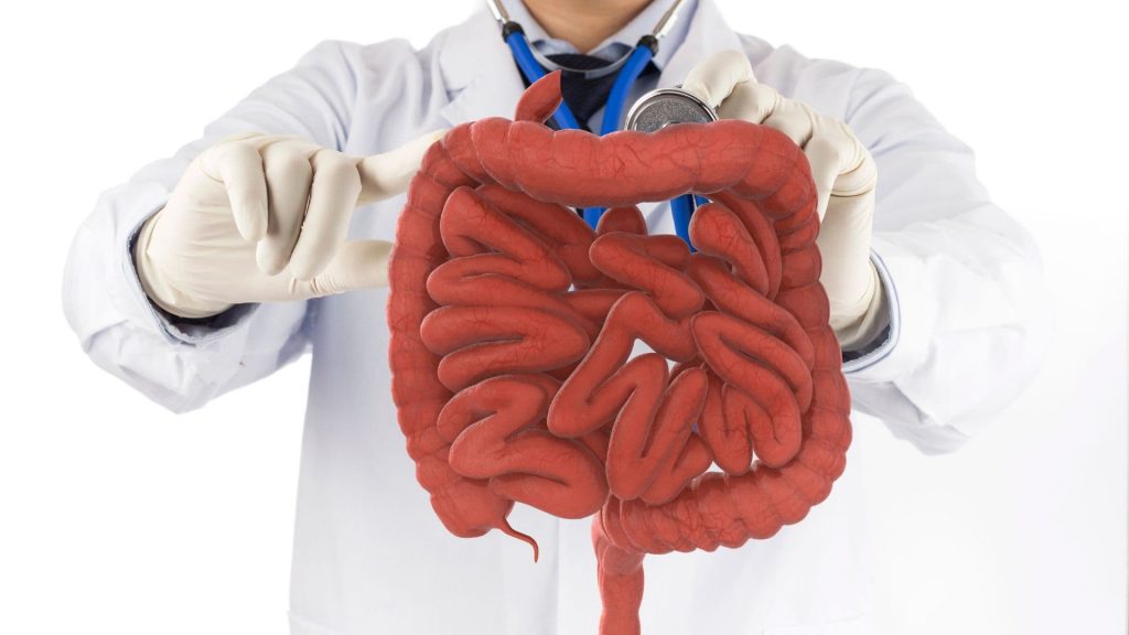 Obstrucciones intestinales en San Luis Potosí