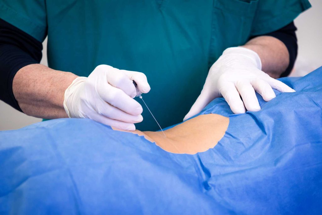 Cirugía de hernia en San Luis Potosí