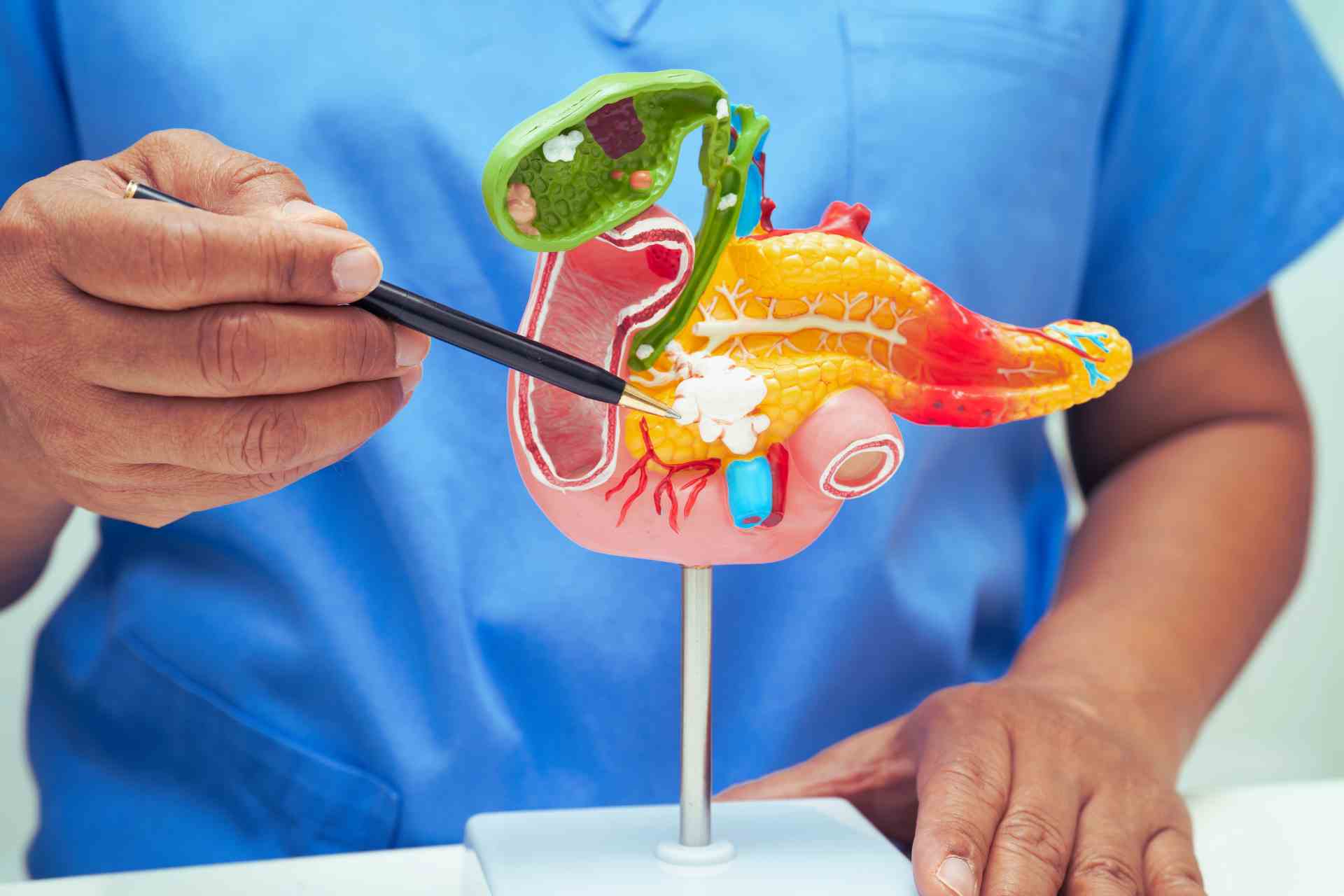 Especialista en pancreatitis en San Luis Potosí