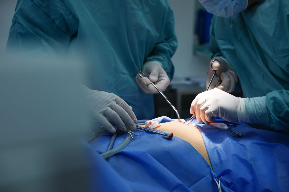 Gastrostomía laparoscópica en San Luis Potosí