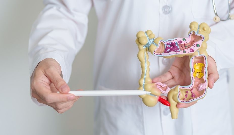 cirugia-colorrectal-sin-colostomia-permanente-en-san-luis-potosi